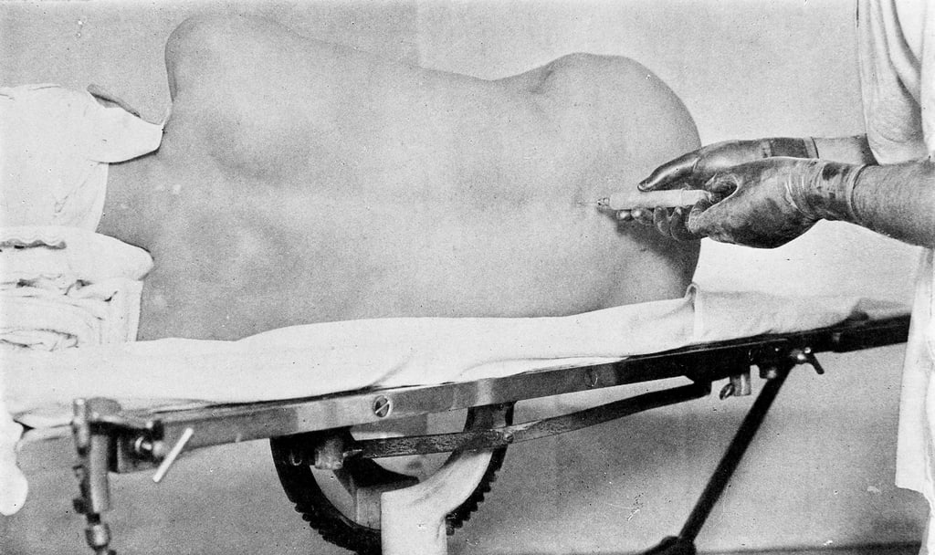 "Spinal anaesthesia..." Evans, 1929 Wellcome M0009568